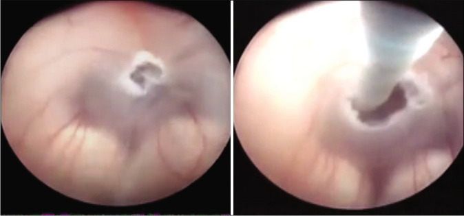 Figure 2: