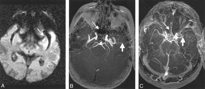 Fig 5.