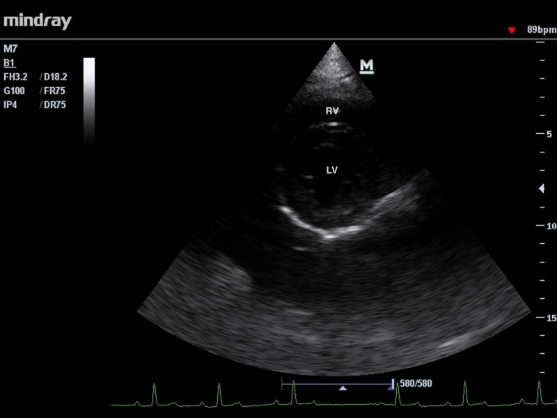 Fig 2