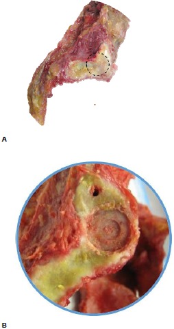 Fig. (2)