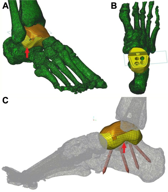 Figure 2