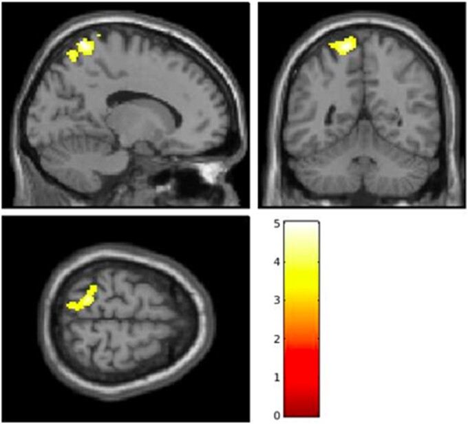 Figure 5