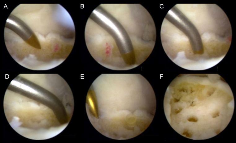 Fig. 4