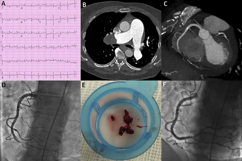 Figure 1