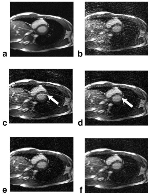 FIG. 6