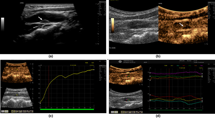 FIGURE 2