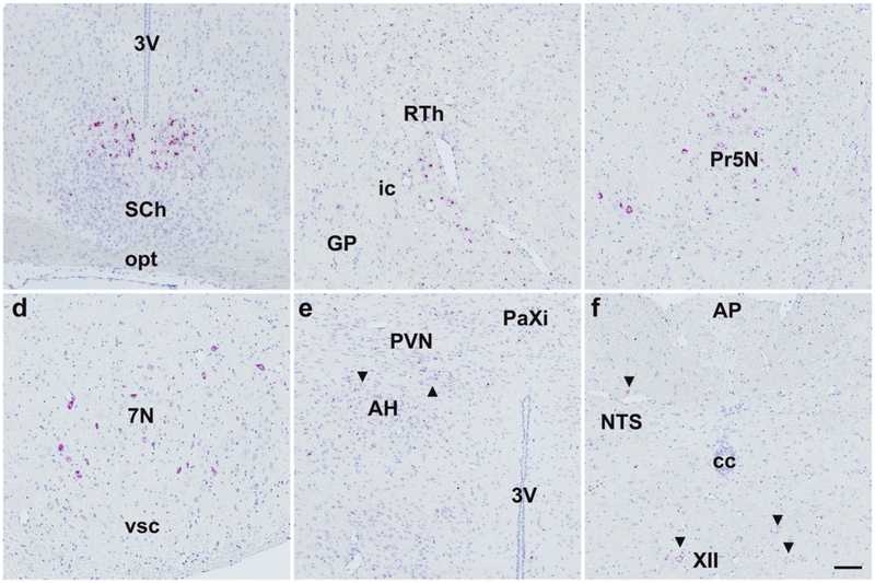 Figure 11.