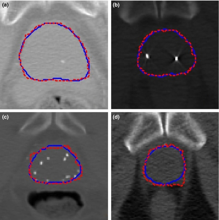 Figure 11