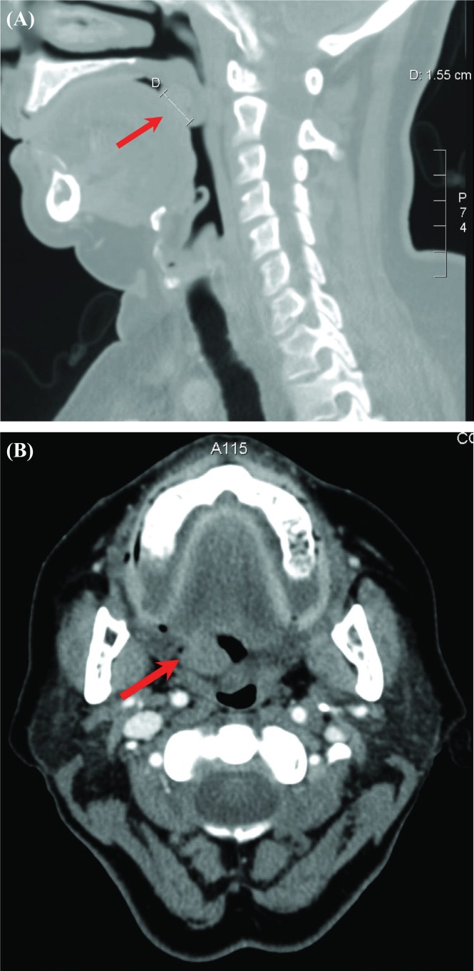 FIGURE 1