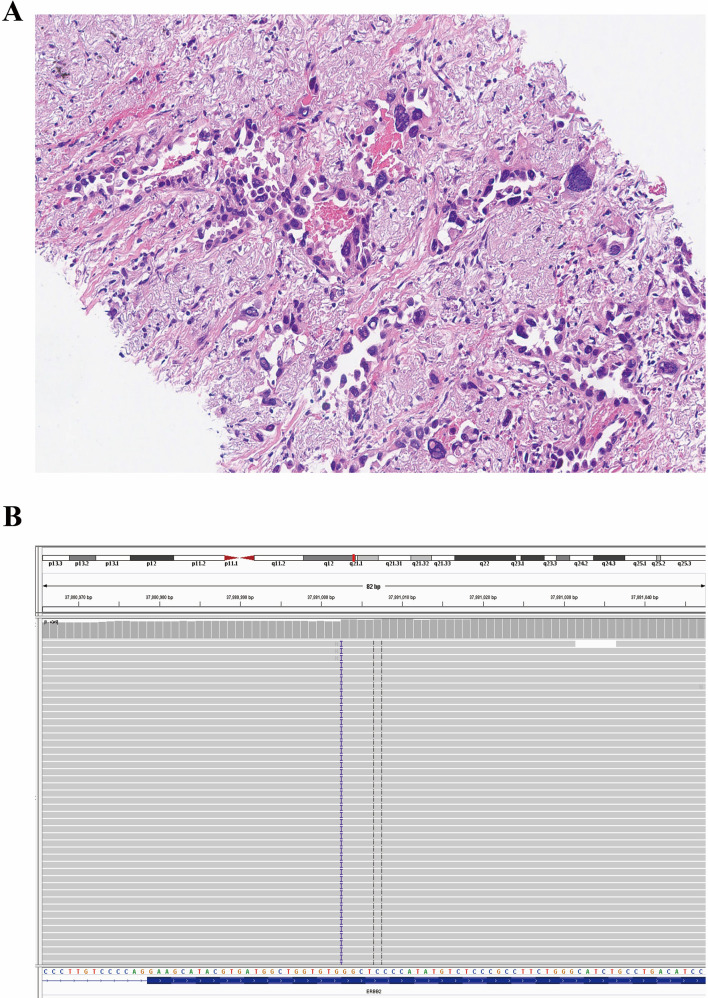 Fig. 4