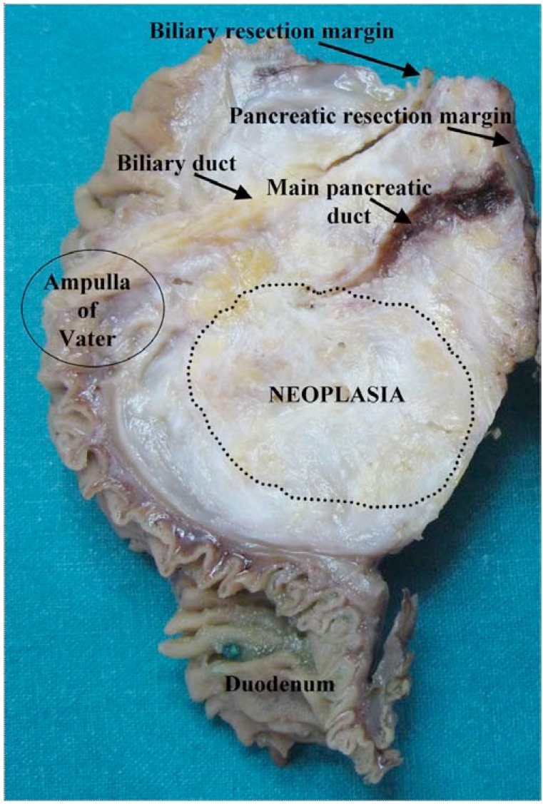 Fig. (2)