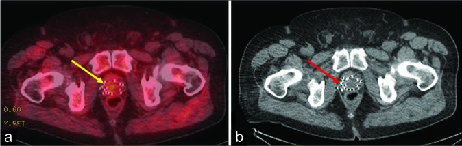 Figure 2: