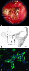 FIG. 1