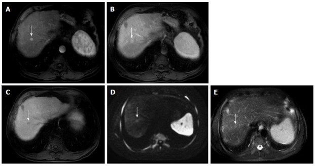 Figure 18