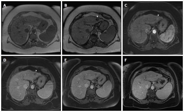 Figure 14