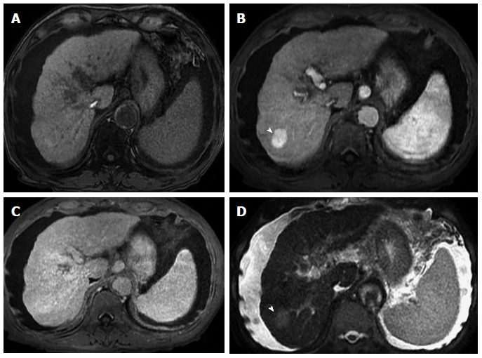 Figure 17