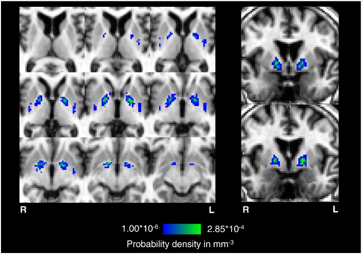 Fig. 3