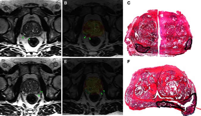 Fig. 2