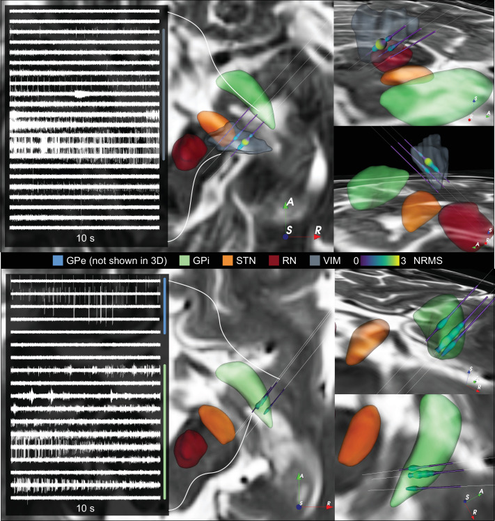 Figure 4—figure supplement 1.