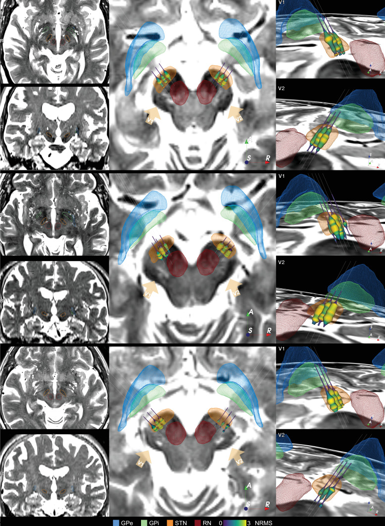 Figure 4—figure supplement 2.