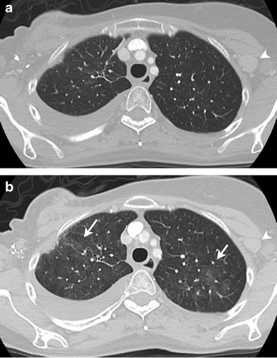 Fig. 9