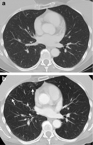 Fig. 12