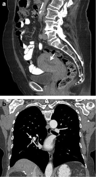 Fig. 10