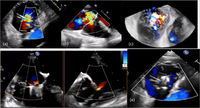 Figure 3: