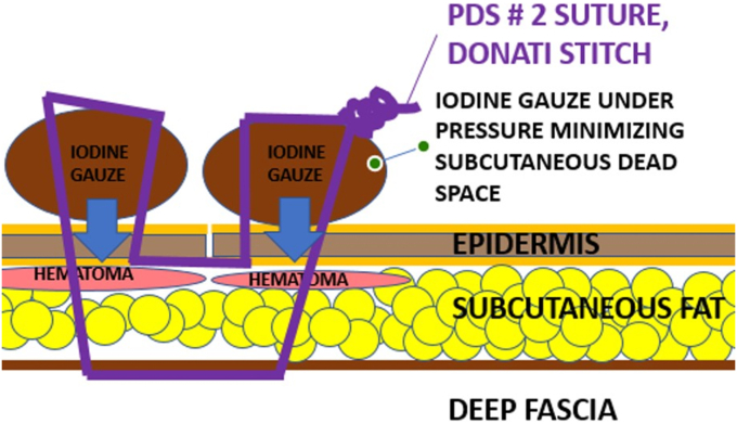 Figure 2