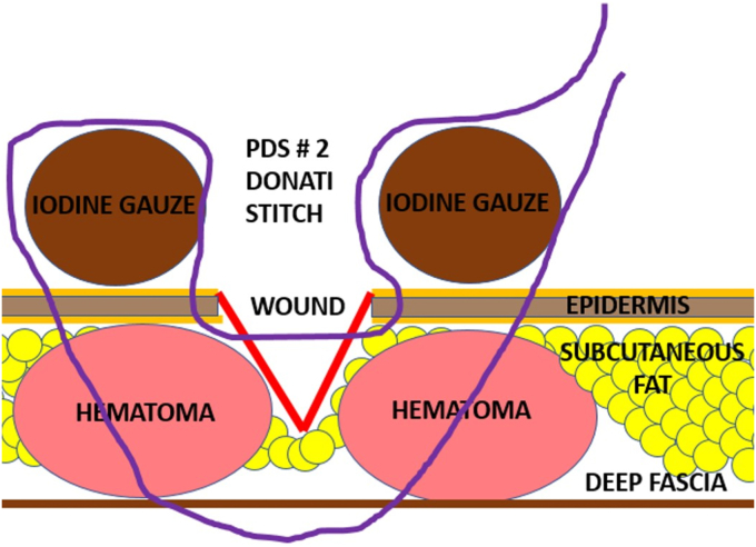 Figure 1