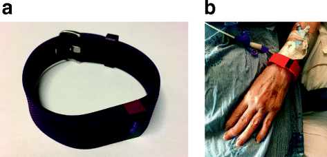 Fig. 1