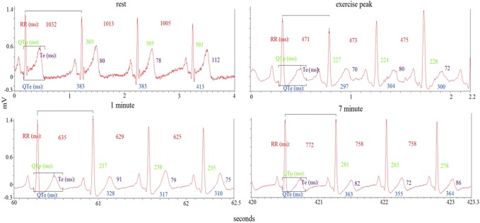 Fig. 1