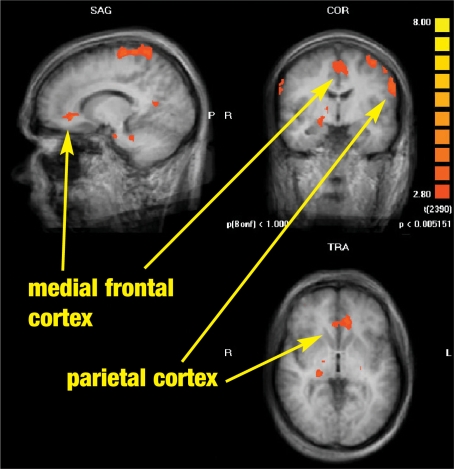 FIGURE 2B.