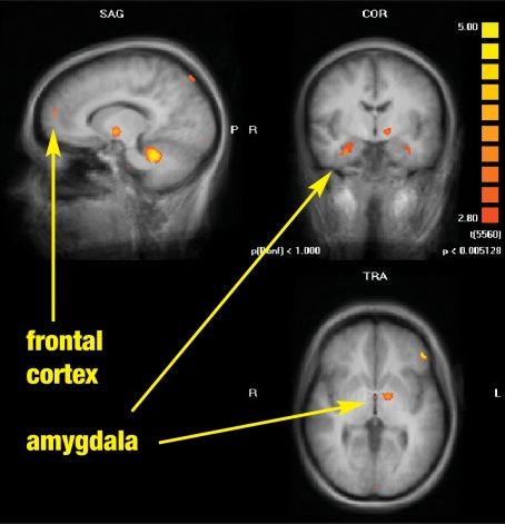 FIGURE 1A.