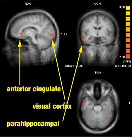 FIGURE 2A.