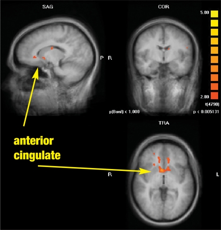 FIGURE 1B.