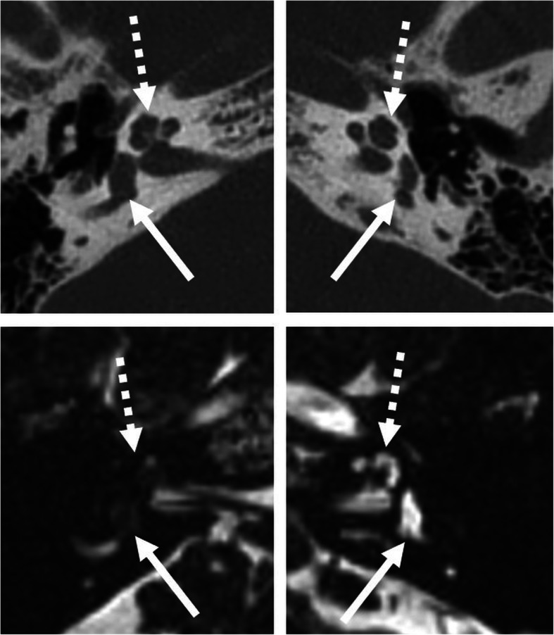 Fig. 15