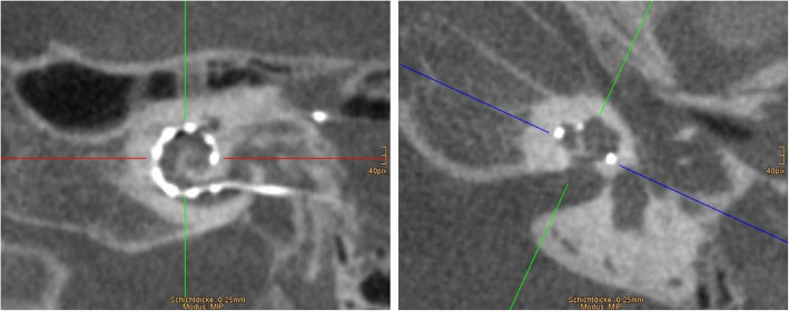 Fig. 19