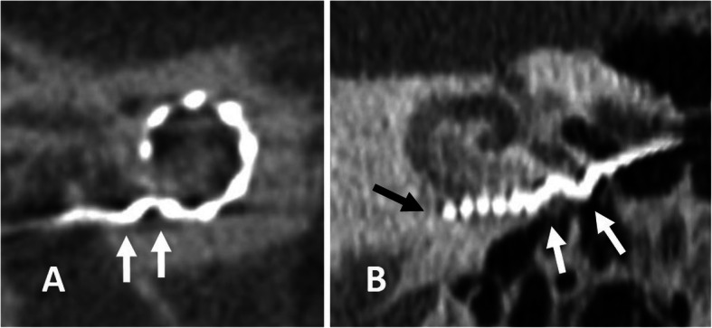 Fig. 28.