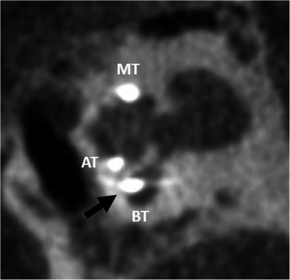 Fig. 24