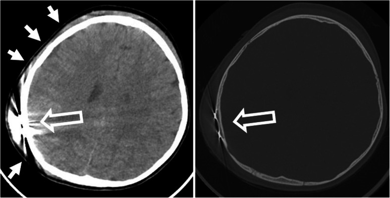 Fig. 35