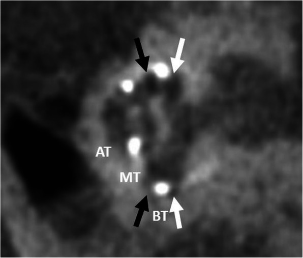 Fig. 23