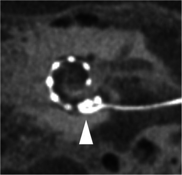 Fig. 30