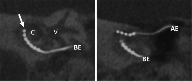 Fig. 21