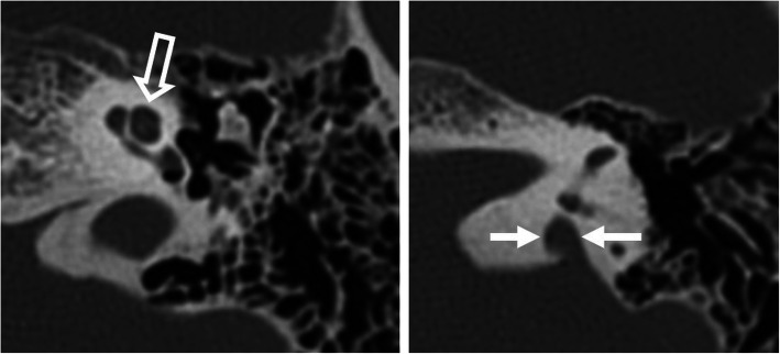 Fig. 11