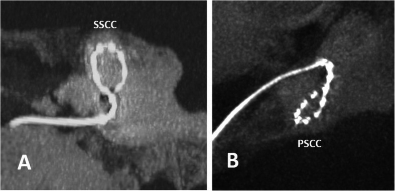 Fig. 33