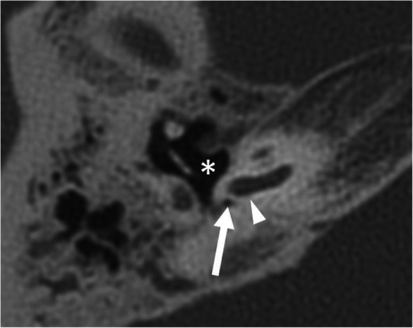 Fig. 13