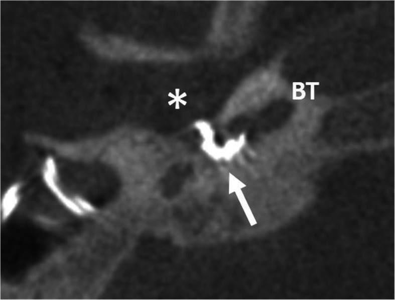 Fig. 31