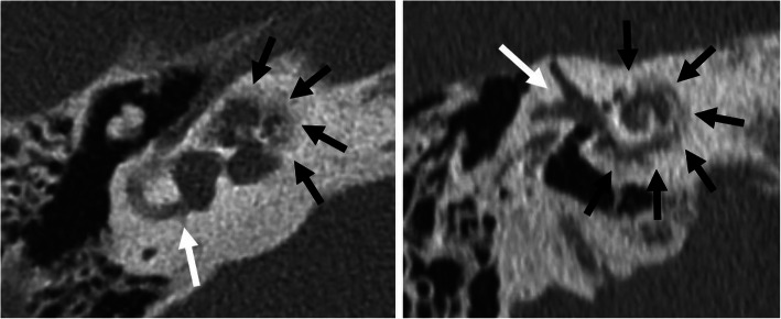 Fig. 16