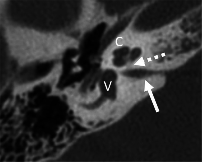 Fig. 14